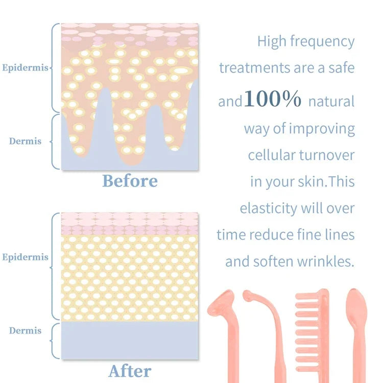 Orivelana™️ 4-in-1  Portable Skin Therapy for Acne, Wrinkles & Radiance